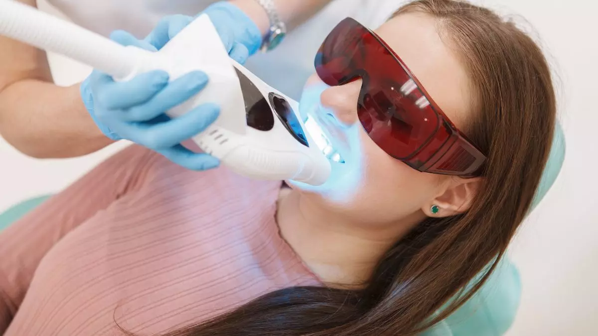 Sbiancamento dentale professionale