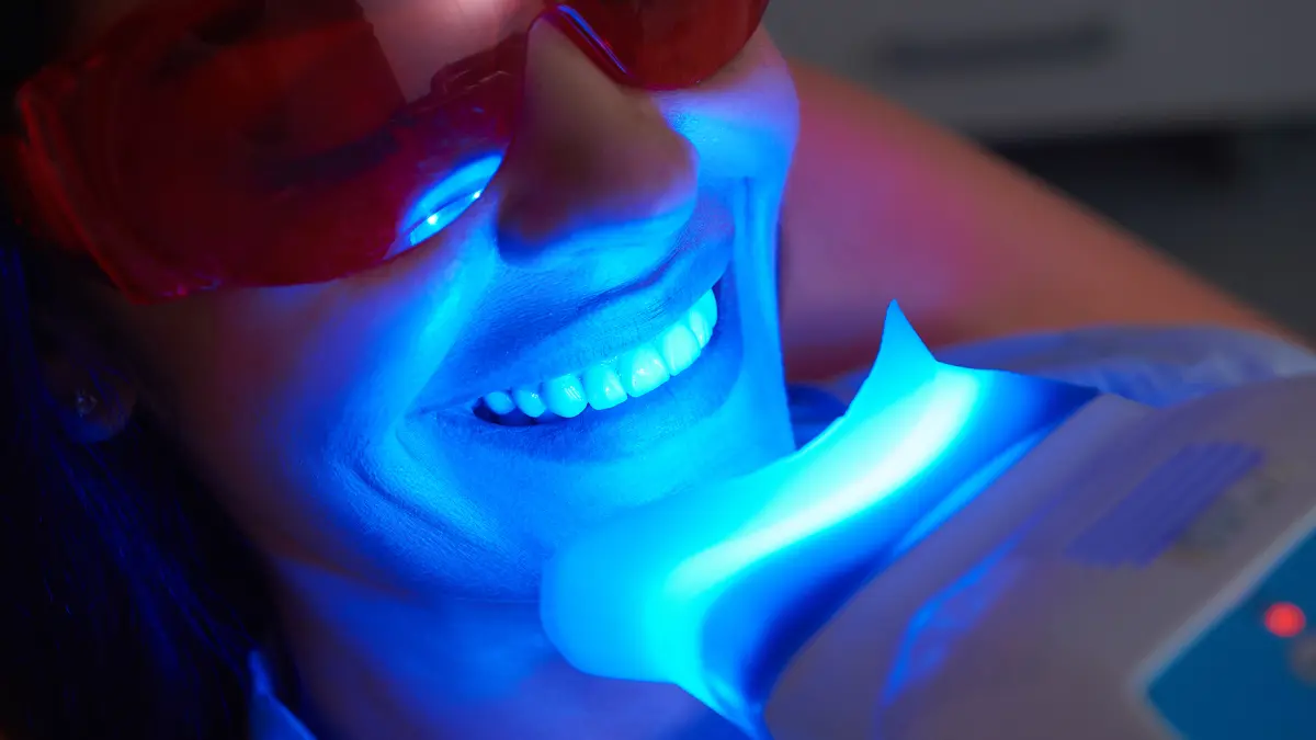 Sbiancamento dentale: d’estate fai risplendere il tuo sorriso!