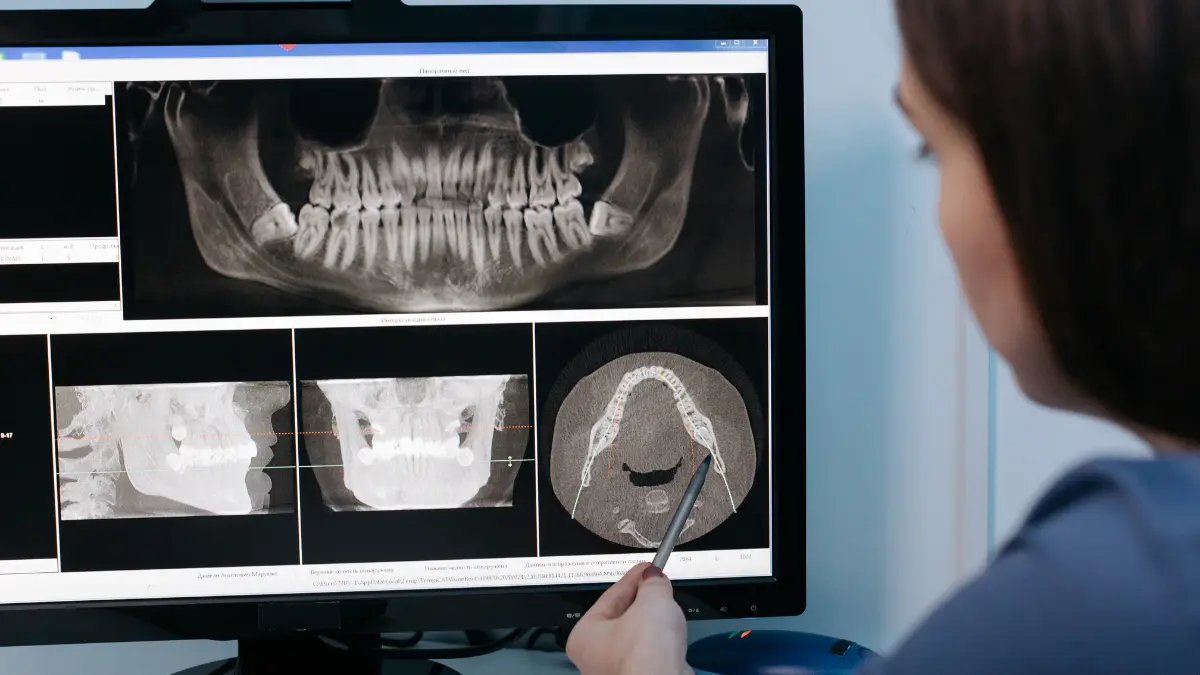 Implantologia digitale: precisione, comfort e sicurezza
